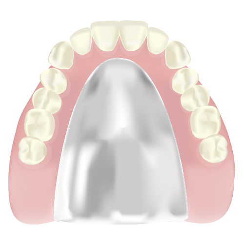 コバルトクロム床義歯のイラスト
