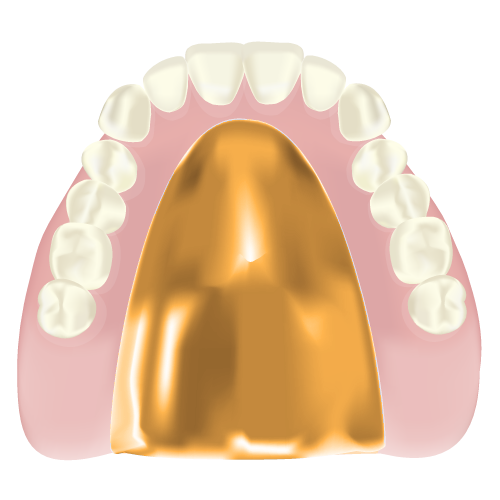 ゴールド床義歯のイラスト